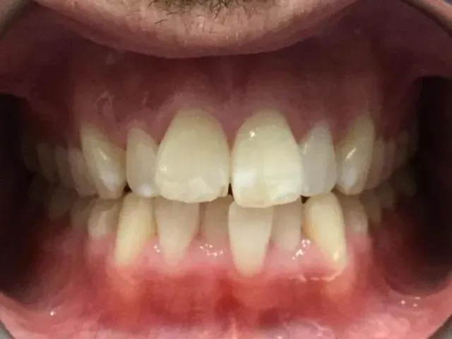 Image 9 Image 9