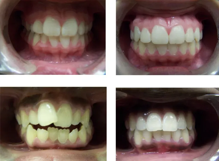 Lovely Smiles Orthodontics: Nicole Thompson, D.M.D. Lovely Smiles Orthodontics: Nicole Thompson, D.M.D.