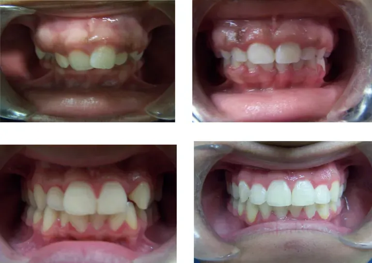 Lovely Smiles Orthodontics: Nicole Thompson, D.M.D. Lovely Smiles Orthodontics: Nicole Thompson, D.M.D.