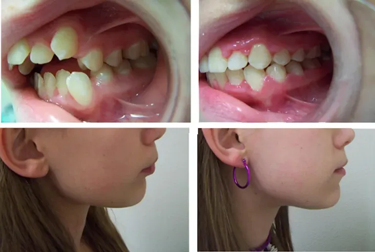 Lovely Smiles Orthodontics: Nicole Thompson, D.M.D. Lovely Smiles Orthodontics: Nicole Thompson, D.M.D.