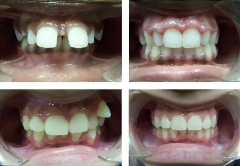 Lovely Smiles Orthodontics: Nicole Thompson, D.M.D. Lovely Smiles Orthodontics: Nicole Thompson, D.M.D.