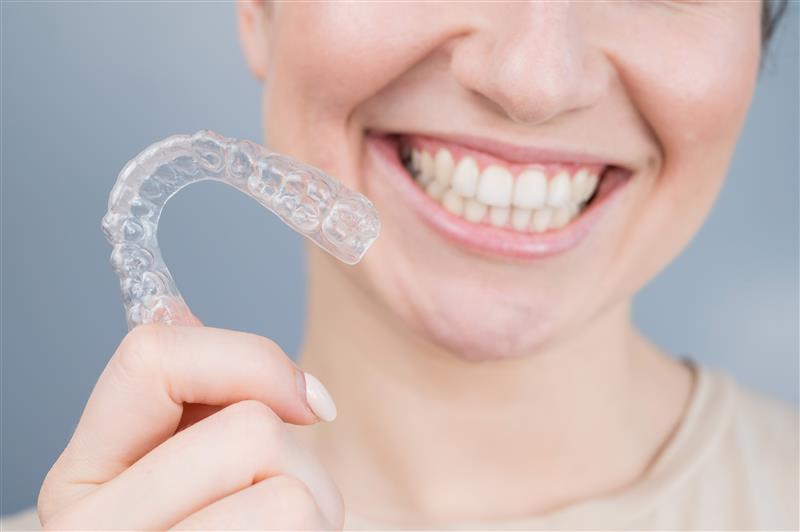 Retainers Retainers